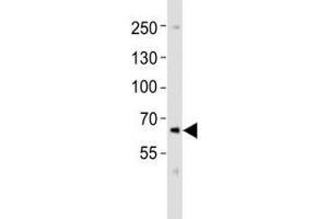 Western Blotting (WB) image for anti-Proprotein Convertase Subtilisin/kexin Type 9 (PCSK9) (C-Term) antibody (ABIN3032340)