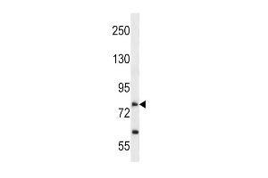 Western Blotting (WB) image for anti-Solute Carrier Family 28 (Sodium-Coupled Nucleoside Transporter), Member 2 (SLC28A2) (AA 14-42), (N-Term) antibody (ABIN5534691)