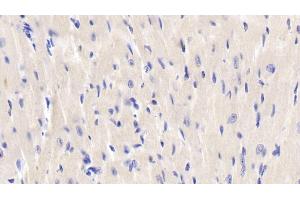 Detection of JNK1 in Mouse Cardiac Muscle Tissue using Polyclonal Antibody to c-Jun N-terminal Kinase 1 (JNK1) (C-Jun N-Terminal Kinases (AA 138-382) 抗体)