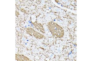 Immunohistochemistry of paraffin-embedded human brain using APP Rabbit mAb (ABIN7265575) at dilution of 1:100 (40x lens). (APP 抗体)