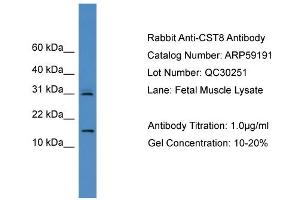 WB Suggested Anti-CST8  Antibody Titration: 0. (CST8 抗体  (N-Term))