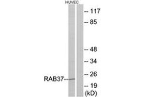 Western blot analysis of extracts from HuvEc cells, using RAB37 Antibody. (RAB37 抗体  (AA 170-219))