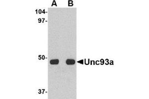 Western blot analysis of Unc93a in HeLa cell lysate with this product at (A) 0. (UNC93A 抗体  (C-Term))