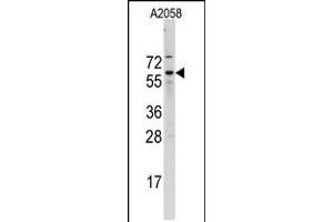 Western blot analysis of Cdc25B Antibody (A166) in A2058 cell line lysates (35ug/lane) (CDC25B 抗体  (N-Term))