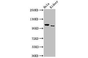 Western Blotting (WB) image for anti-NIMA (Never in Mitosis Gene A)- Related Kinase 9 (NEK9) (AA 821-979) antibody (ABIN7169116)