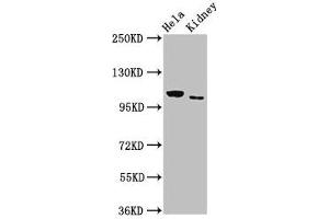 Western Blot Positive WB detected in: Hela whole cell lysate, Rat kidney tissue All lanes: NEK9 antibody at 3 μg/mL Secondary Goat polyclonal to rabbit IgG at 1/50000 dilution Predicted band size: 108 kDa Observed band size: 108 kDa (NEK9 抗体  (AA 821-979))