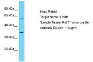 Image no. 1 for anti-YTH Domain Family, Member 1 (YTHDF1) (AA 127-176) antibody (ABIN6750377) (YTHDF1 抗体  (AA 127-176))