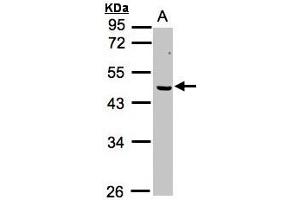 Image no. 1 for anti-Excision Repair Cross-Complementing Rodent Repair Deficiency, Complementation Group 8 (ERCC8) (AA 1-164) antibody (ABIN467383) (ERCC8 抗体  (AA 1-164))