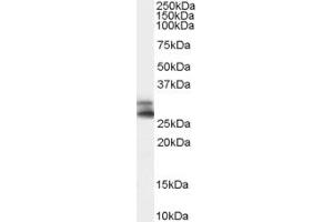 Western Blotting (WB) image for anti-ADP-Ribosylation-Like Factor 6 Interacting Protein 4 (ARL6IP4) (Middle Region) antibody (ABIN2790727) (ARL6IP4 抗体  (Middle Region))