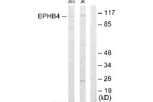 Western blot analysis of extracts from 293 cells and Jurkat cells, using EPHB4 antibody.