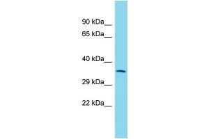 Host: Rabbit Target Name: Igbp1b Sample Type: Rat Thymus lysates Antibody Dilution: 1. (IGBP1B 抗体  (Middle Region))