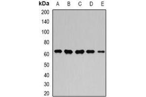 Western blot analysis of GPI expression in MCF7 (A), Hela (B), mouse kidney (C), mouse heart (D), rat brain (E) whole cell lysates. (GPI 抗体)