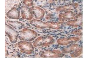 Immunohistochemistry (IHC) image for anti-Chloride Intracellular Channel 1 (CLIC1) (AA 79-241) antibody (ABIN7434869)
