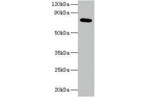 Western blot All lanes: ARPC3 antibody at 2 μg/mL + 293T whole cell lysate Secondary Goat polyclonal to rabbit IgG at 1/15000 dilution Predicted band size: 21 kDa Observed band size: 75 kDa (ARPC3 抗体  (AA 2-175))