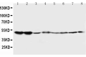 Lane 8: COLO320 Cell Lysate (HTR2A 抗体  (C-Term))