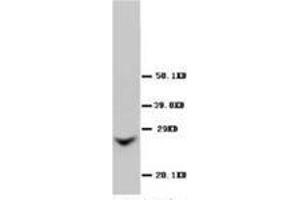 Western blot analysis of Rat liver sections using Connexin 26 antibody (GJB2 抗体  (Middle Region))