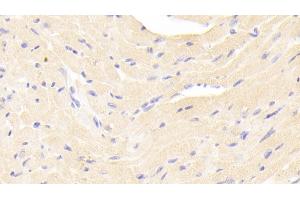 Detection of ERb in Mouse Cardiac Muscle Tissue using Polyclonal Antibody to Estrogen Receptor Beta (ERb) (ESR2 抗体  (AA 46-530))