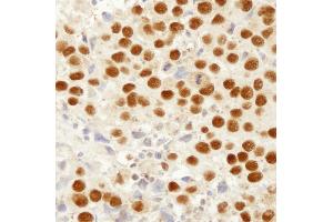 Immunohistochemistry (IHC) image for anti-Mismatch Repair Protein 2 (MSH2) (C-Term) antibody (ABIN7448673) (MSH2 抗体  (C-Term))