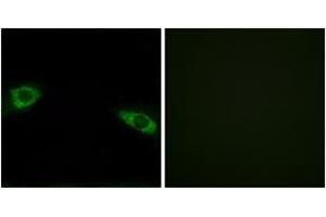 Immunofluorescence analysis of HuvEc cells, using RPS4Y1 Antibody. (RPS4Y1 抗体  (AA 214-263))