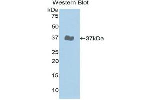 Western Blotting (WB) image for anti-Janus Kinase 2 (JAK2) (AA 508-800) antibody (ABIN3203633) (JAK2 抗体  (AA 508-800))