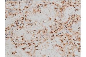 Immunohistochemistry (IHC) image for anti-cAMP Responsive Element Binding Protein 1 (CREB1) (pSer133) antibody (ABIN6256130)