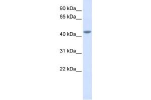 WB Suggested Anti-IL11RA Antibody Titration:  0. (IL11RA 抗体  (Middle Region))