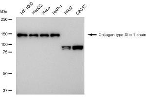 Western blotting analysis using Collagen type XI alpha 1 chain antibody (ABIN7798128).
