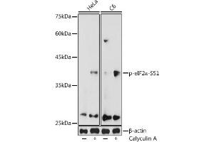 Western blot analysis of extracts of various cell lines, using Phospho-eIF2α-S51 antibody (ABIN3020189, ABIN3020190, ABIN3020191 and ABIN1681553) at 1:1000 dilution.