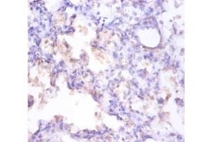 Immunohistochemistry of paraffin-embedded human prostate using CLU / Clusterin antibody at dilution of 1:100. (Clusterin 抗体  (FITC))