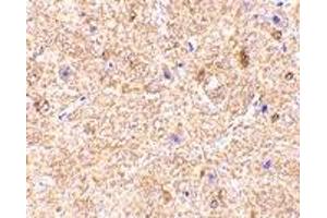 Immunohistochemistry (IHC) image for anti-Mitochondrial Antiviral Signaling Protein (MAVS) (Middle Region) antibody (ABIN1031160) (MAVS 抗体  (Middle Region))
