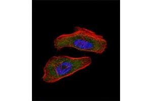 Fluorescent confocal image of HeLa cell stained with HIF1 alpha antibody at 1:25.