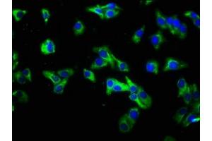 Immunofluorescence staining of HepG2 cells with ABIN7156855 at 1:333, counter-stained with DAPI. (IL22 Receptor alpha 1 抗体  (AA 250-573))