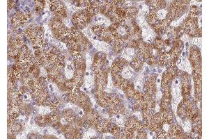 ABIN6277347 at 1/100 staining human liver tissue sections by IHC-P. (CPT2 抗体  (Internal Region))