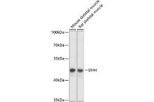 Western blot analysis of extracts of various cell lines using DHH Polyclonal Antibody at dilution of 1:3000. (desert Hedgehog 抗体)