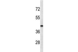 LHX2 antibody western blot analysis in MDA-MB435 lysate. (LHX2 抗体)
