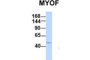Western Blotting (WB) image for anti-Myoferlin (MYOF) (C-Term) antibody (ABIN2782797)