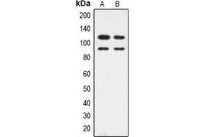 Western blot analysis of CDK11B expression in HepG2 (A), Hela (B) whole cell lysates. (CDK11 抗体  (N-Term))