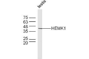 Mouse testis lysates probed with HEMK1 Polyclonal Antibody, Unconjugated  at 1:300 dilution and 4˚C overnight incubation. (HEMK1 抗体  (AA 21-120))