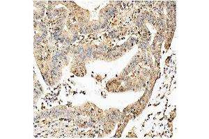 IHC analysis of Ch TOG/CKAP5 using anti-Ch TOG/CKAP5 antibody (ABIN7599106).