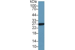 Detection of GSTa5 in Human Liver lysate using Polyclonal Antibody to Glutathione S Transferase Alpha 5 (GSTa5) (GSTa5 抗体  (AA 1-221))