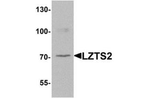 Western blot analysis of LZTS2 in human kidney tissue lysate with LZTS2 Antibody  at 1 μg/ml. (LZTS2 抗体  (N-Term))