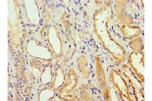 Immunohistochemistry of paraffin-embedded human kidney tissue using ABIN7142020 at dilution of 1:100 (AGPAT1 抗体  (AA 204-283))