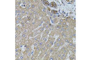 Immunohistochemistry of paraffin-embedded human liver injury using FLNB antibody (ABIN5971317) at dilution of 1/100 (40x lens). (FLNB 抗体)