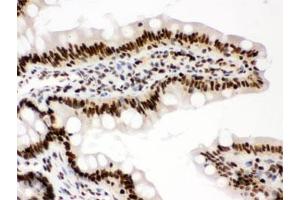 IHC testing of FFPE rat intestine with RBBP4 antibody. (RBBP4 / RbAp48 / NURF55 抗体)