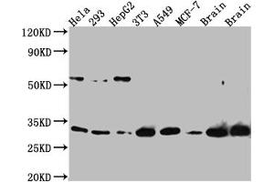 Western Blot Positive WB detected in: Hela whole cell lysate, 293 whole cell lysate, HepG2 whole cell lysate, NIH/3T3 whole cell lysate, A549 whole cell lysate, MCF-7 whole cell lysate, Mouse Brain whole cell lysate, Rat Brain whole cell lysate All lanes: PGAM1 Antibody at 1:1000 Secondary Goat polyclonal to rabbit IgG at 1/50000 dilution Predicted band size: 28 kDa Observed band size: 29 kDa (Recombinant PGAM1 抗体)