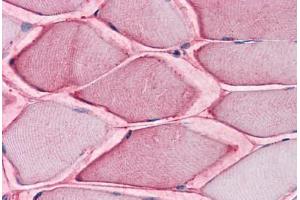 Human Skeletal Muscle: Formalin-Fixed, Paraffin-Embedded (FFPE) (SLC1A5 抗体  (Internal Region))