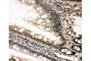 IHC analysis of nmt55/p54nrb using anti-nmt55/p54nrb antibody (ABIN3044530). (NONO 抗体  (N-Term))