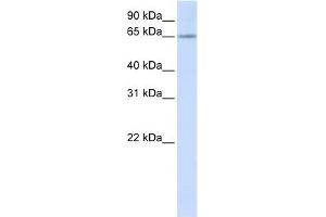 RSPRY1 antibody used at 1 ug/ml to detect target protein. (RSPRY1 抗体  (N-Term))