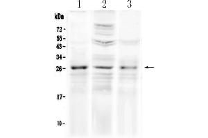 Western blot analysis of FGF8 using anti-FGF8 antibody . (FGF8 抗体  (AA 23-233))