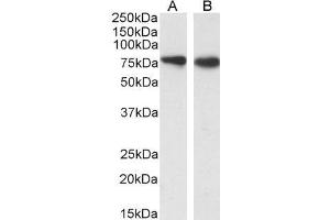 ABIN5539615 (0. (SLC26A6 抗体  (Internal Region))